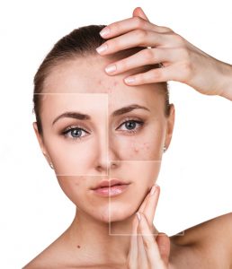 facial