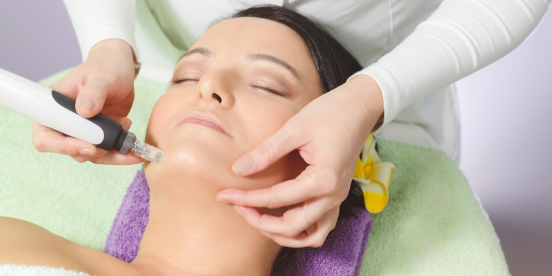 Microneedling vs. Lasers