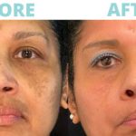 Contour TRL